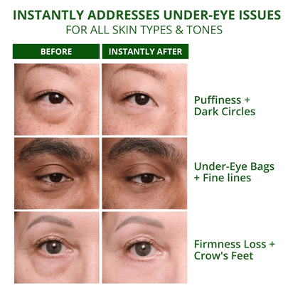 Under-Eye Tightening Cream